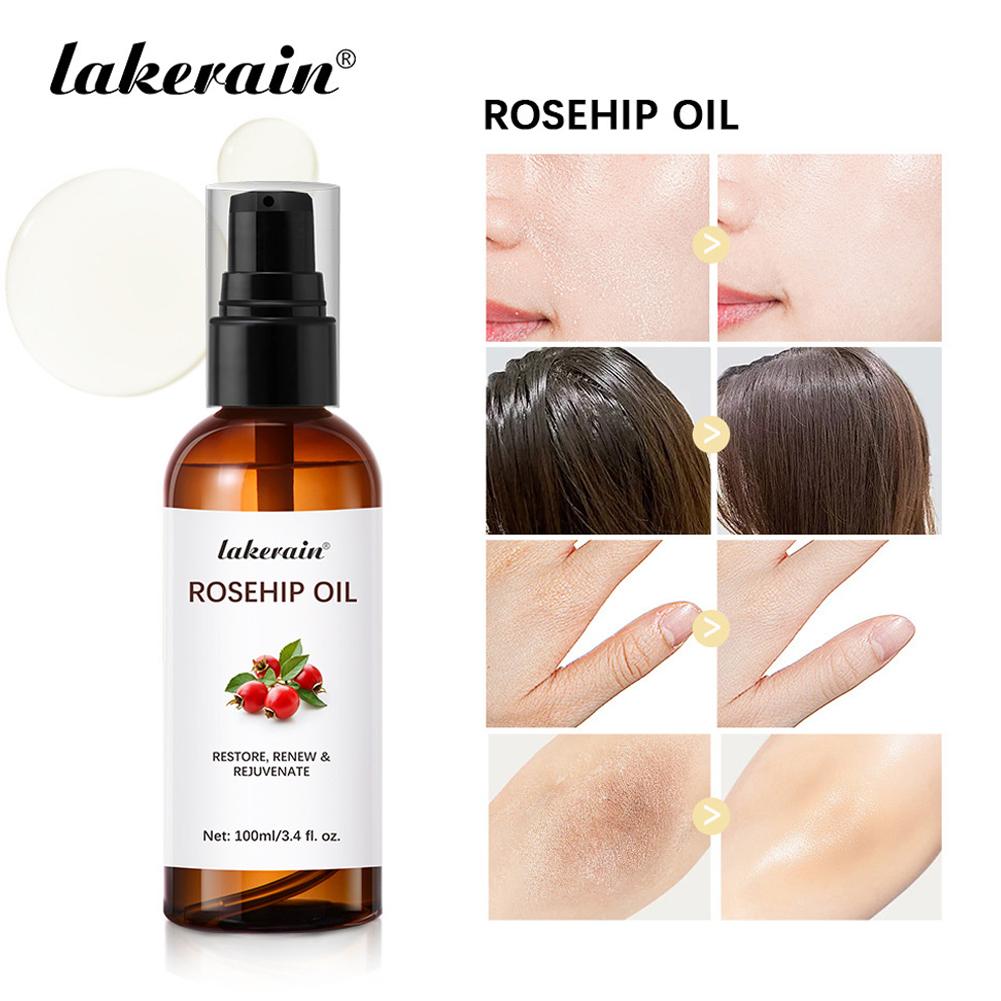 Rozenbottelolie voor gezicht e - Cold Pressed Rose Hip recensie en prijs